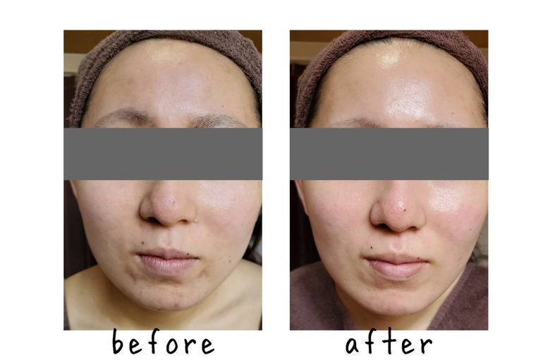 ぞくぞく結果が出ています